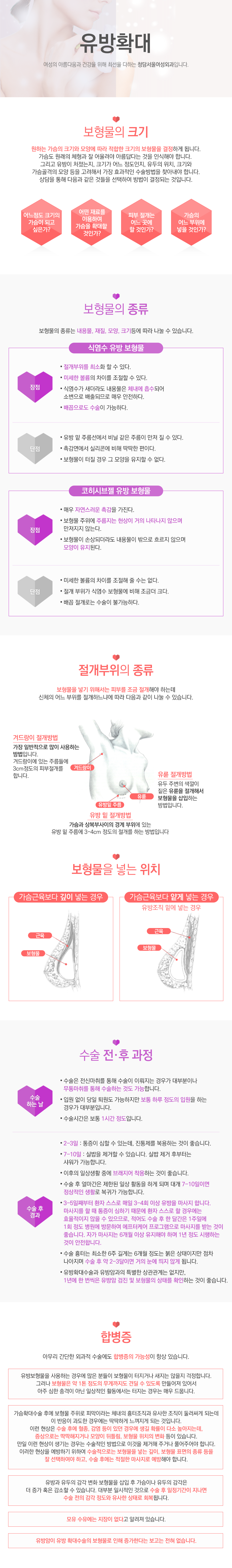 유방확대