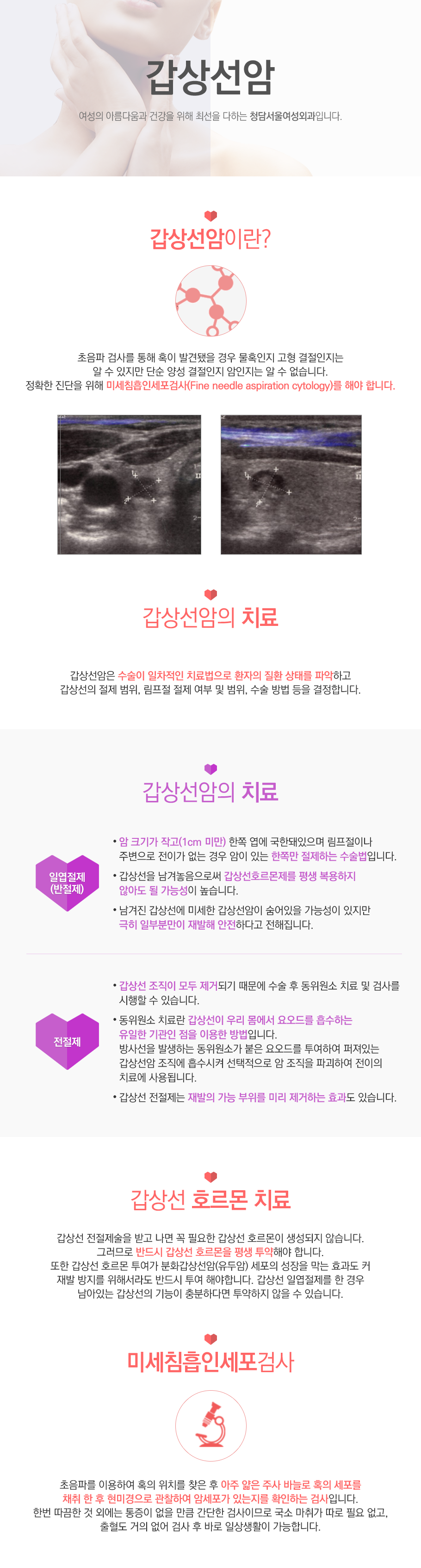 갑상선암