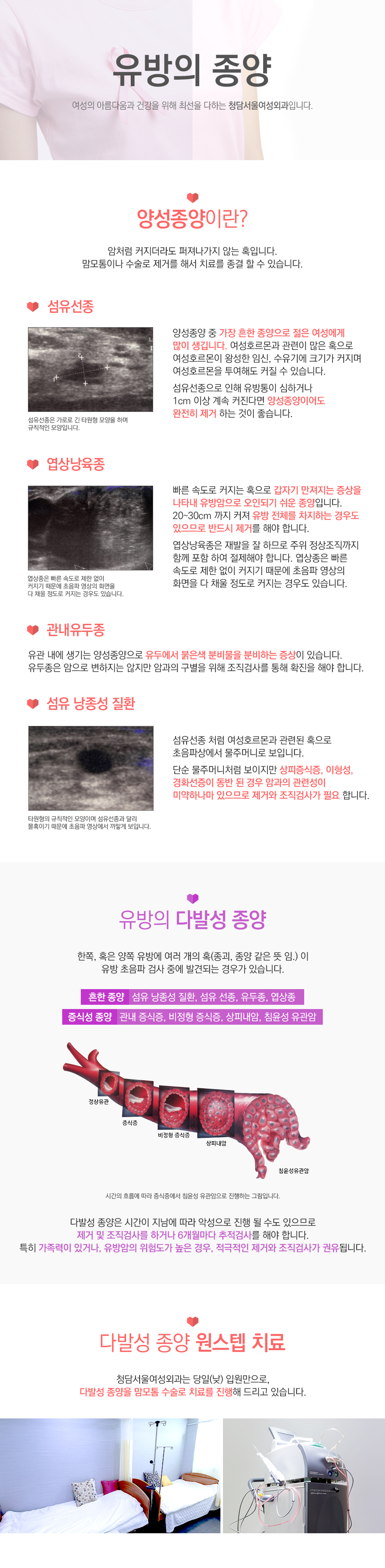 유방의 종양