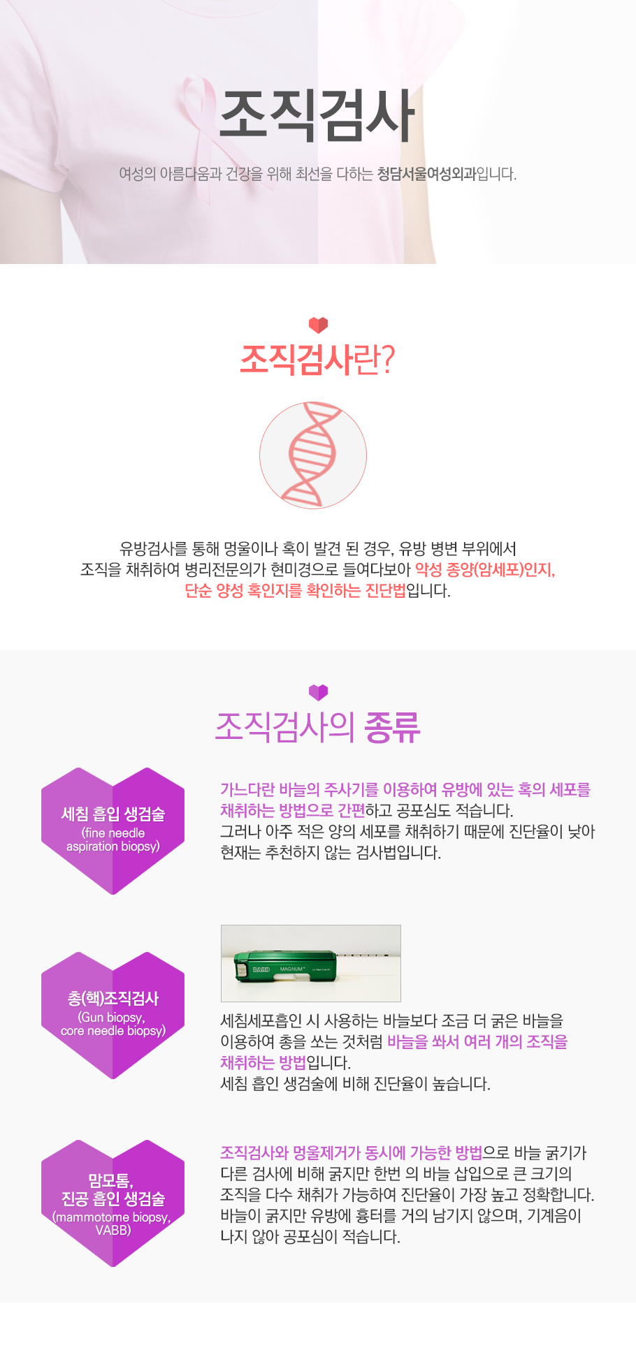 조직검사