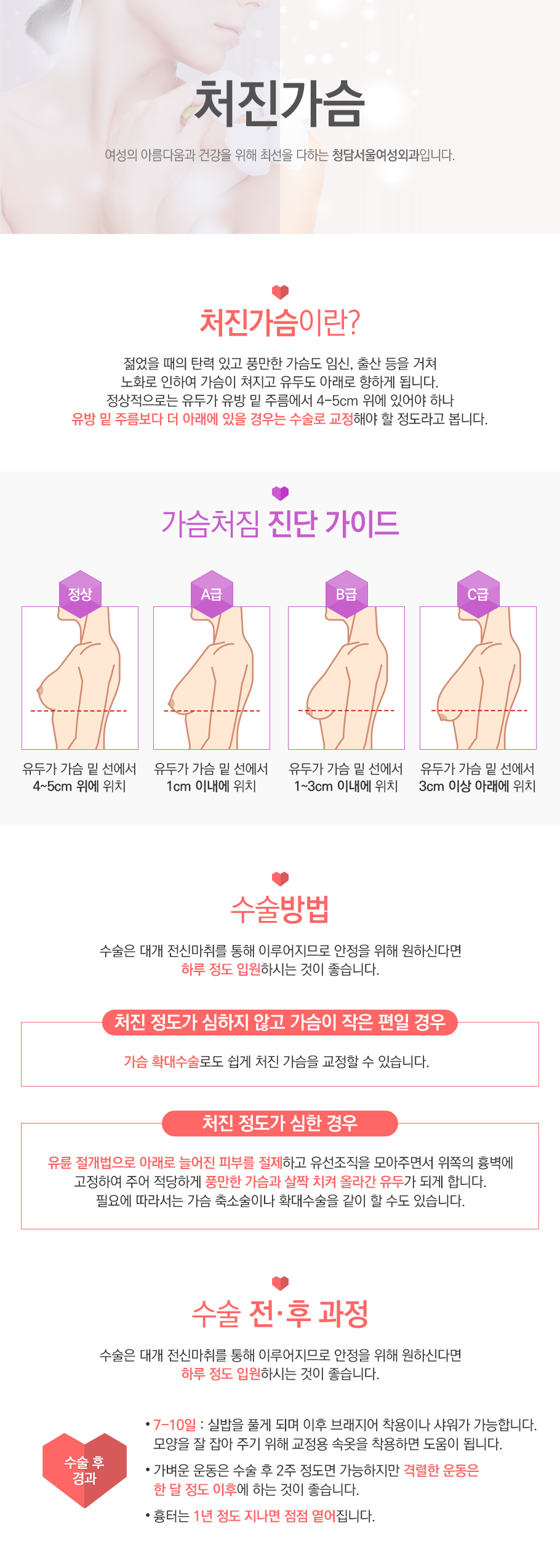 임신중절수술