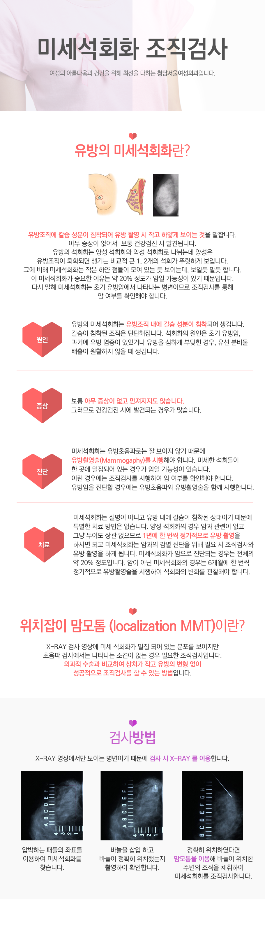 소음순성형